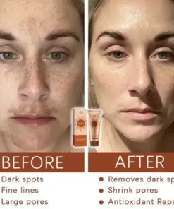 Cheemex® Herbal Spots Peel-Off Facial Mask