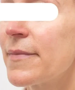 Cheemex® Herbal Spots Peel-Off Facial Mask