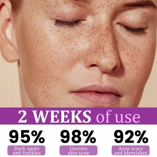 Cheemex® MelantraX Advanced Anti-Hyperpigmentation Essence