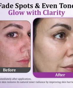 Cheemex® MelantraX Advanced Anti-Hyperpigmentation Essence