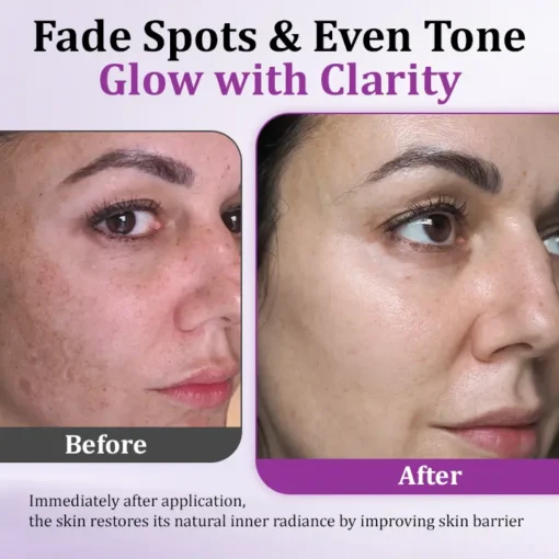 Cheemex® MelantraX Advanced Anti-Hyperpigmentation Essence