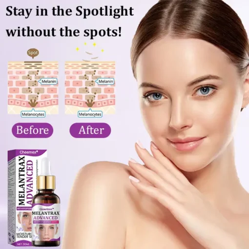 Cheemex® MelantraX Advanced Anti-Hyperpigmentation Essence