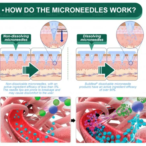 Cheemex® SMGT-GLP-1 Nano Microneedle Patch