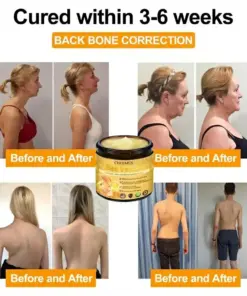 CHEEMEX Bee Venom Advanced Joint and Bone Healing Cream