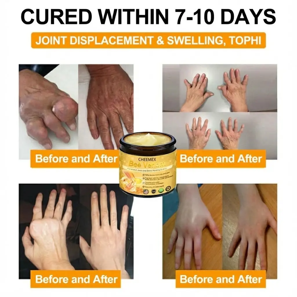 CHEEMEX Bee Venom Advanced Joint and Bone Healing Cream
