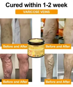 CHEEMEX Bee Venom Advanced Joint and Bone Healing Cream