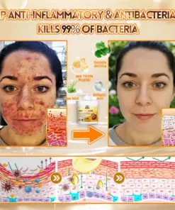 Cheemex® Bee Venom Skin Restoration Cream