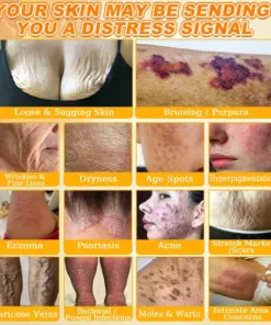 Cheemex® Bee Venom Skin Restoration Cream