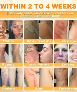 Cheemex® Bee Venom Skin Restoration Cream