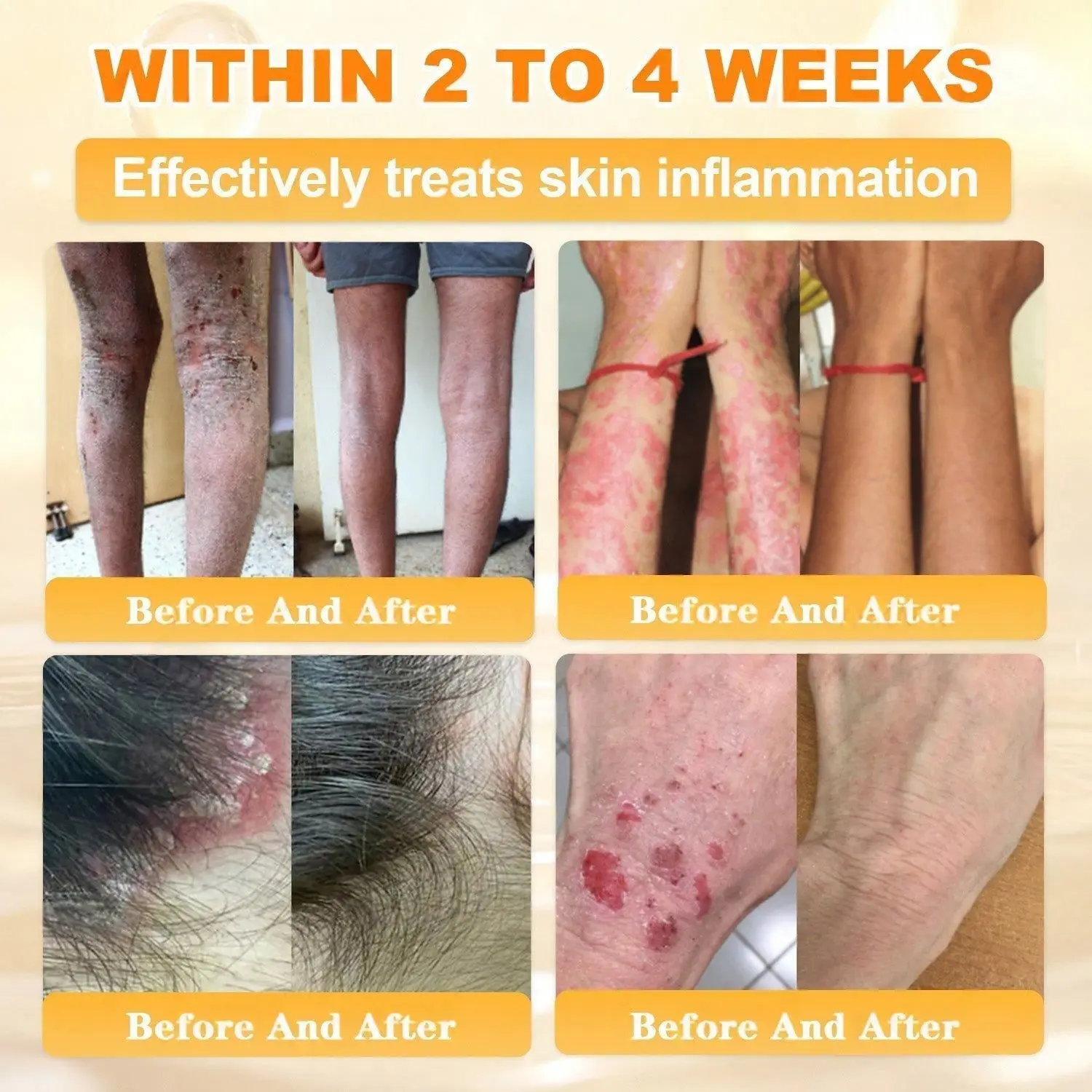 Cheemex® Bee Venom Skin Restoration Cream