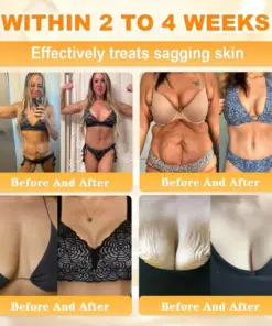 Cheemex® Bee Venom Skin Restoration Cream