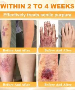 Cheemex® Bee Venom Skin Restoration Cream