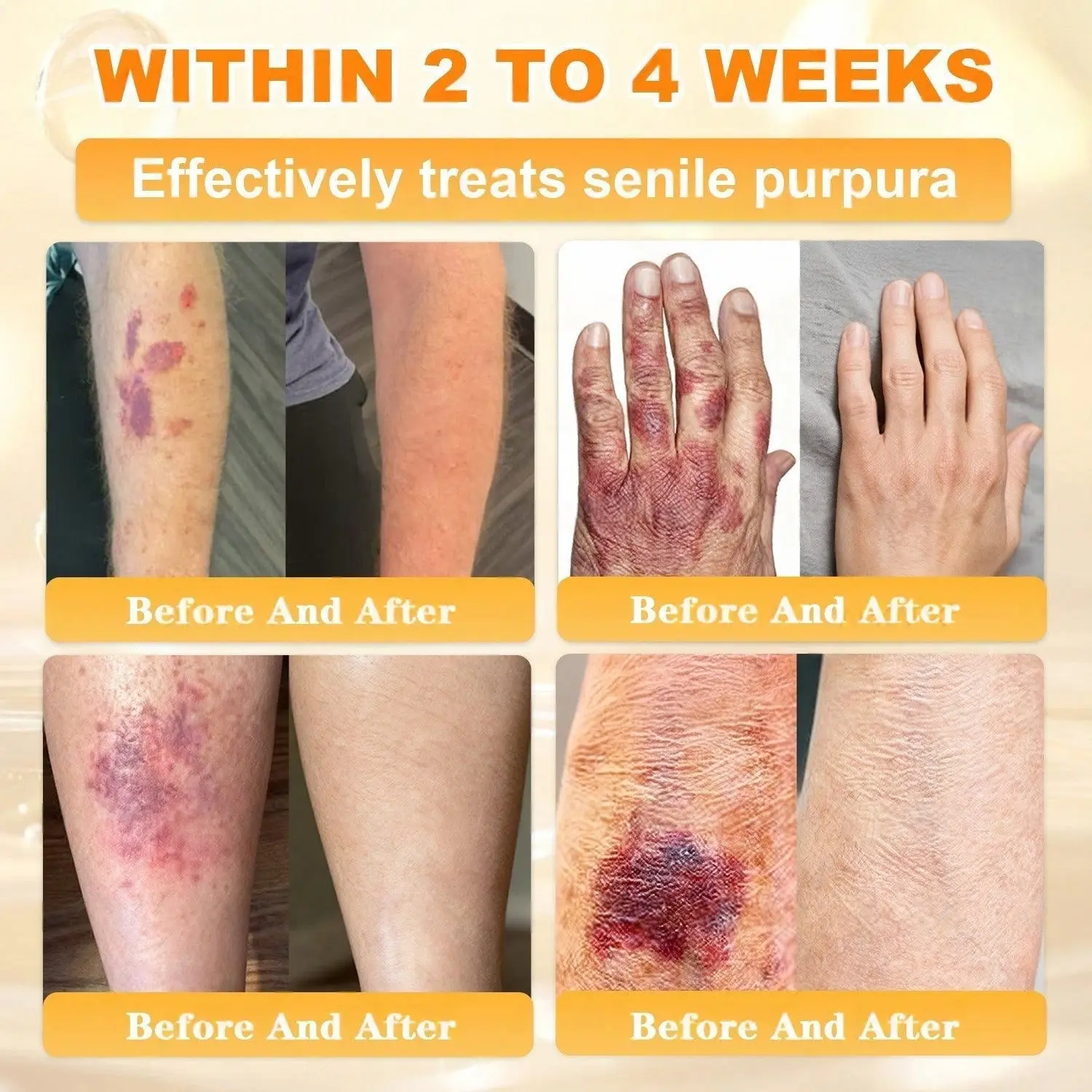 Cheemex® Bee Venom Skin Restoration Cream