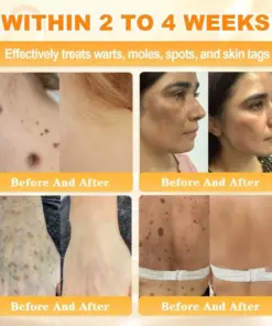 Cheemex® Bee Venom Skin Restoration Cream