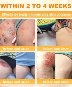 Cheemex® Bee Venom Skin Restoration Cream