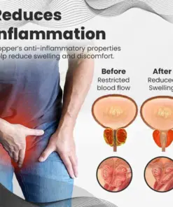 Cheemex™ CopperMag Prostate Therapy Ring