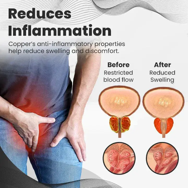 Cheemex™ CopperMag Prostate Therapy Ring