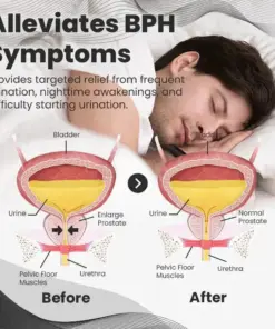 Cheemex™ CopperMag Prostate Therapy Ring