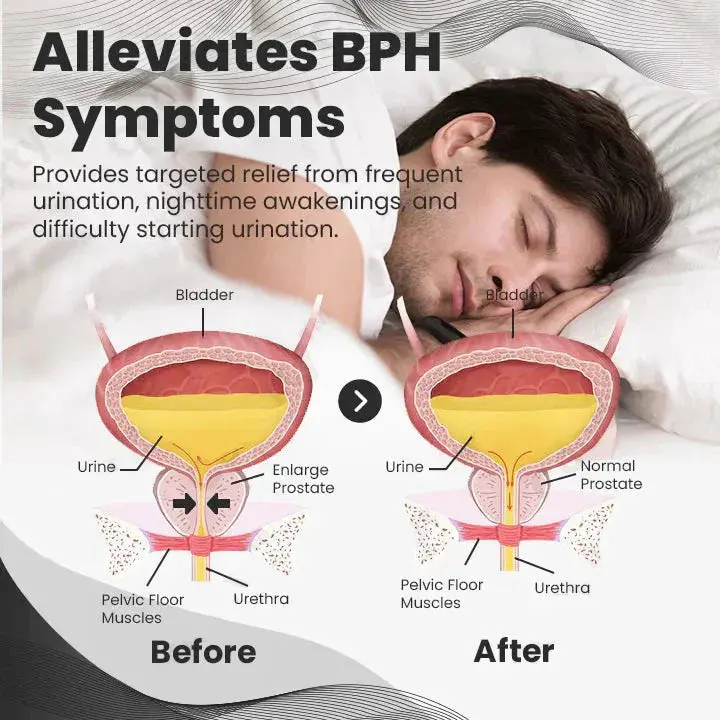 Cheemex™ CopperMag Prostate Therapy Ring