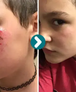 Cheemex® SKINSHIELD QUICKDRYING LIQUID BANDAGE