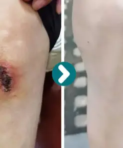 Cheemex® SKINSHIELD QUICKDRYING LIQUID BANDAGE