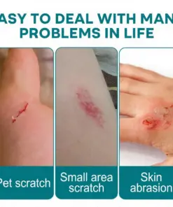 Cheemex® SKINSHIELD QUICKDRYING LIQUID BANDAGE