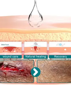 Cheemex® SKINSHIELD QUICKDRYING LIQUID BANDAGE