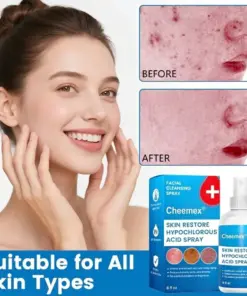 Cheemex® Skin Restore Hypochlorous Acid Spray