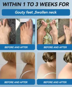 Cheemex® BPC-157 Joint Healing Cream