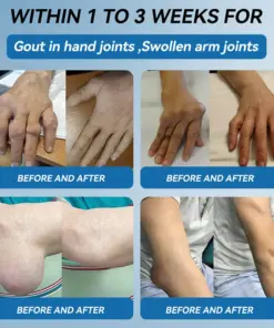 Cheemex® BPC-157 Joint Healing Cream