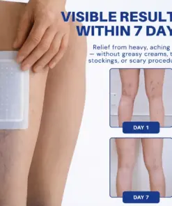 Cheemex® Vein Contour Microneedle Patch