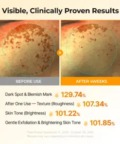Cheemex® Kojic Acid Turmeric TX Toner Pad 70pads - Dark Spot & Pigmentation Care for Uneven Skin Tone