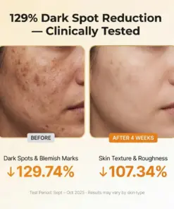 Cheemex® Kojic Acid Turmeric TX Toner Pad 70pads - Dark Spot & Pigmentation Care for Uneven Skin Tone